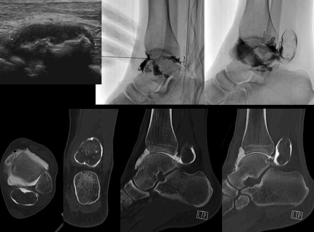 Figure 5 for case Chondroma ( RID4126 )